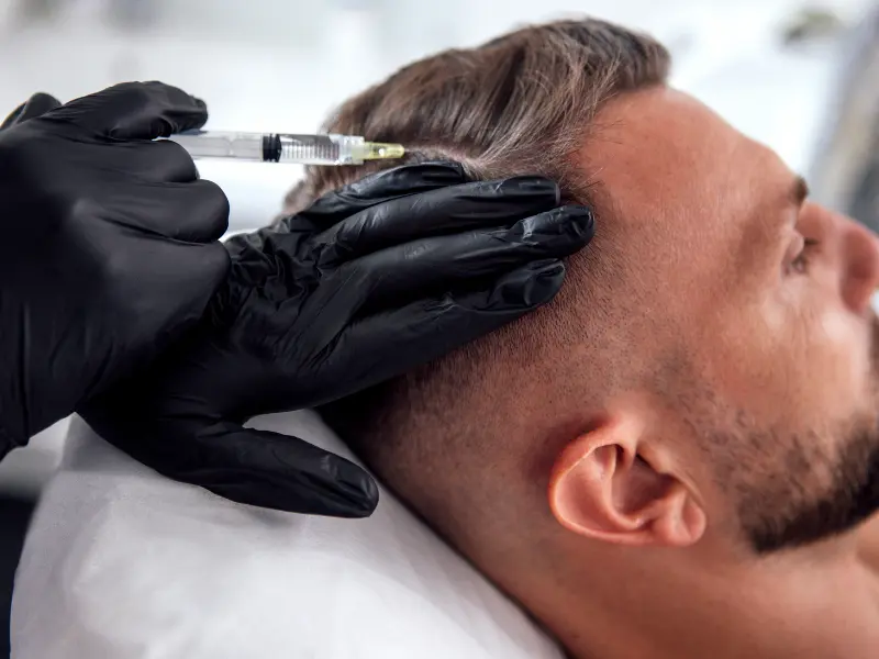 Intradermoterapia